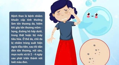  PHÒNG, CHỐNG BỆNH THAN NHỮNG ĐIỀU CẦN BIẾT